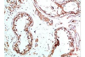 Immunohistochemical analysis of paraffin-embedded human-testis, antibody was diluted at 1:200 (IL-31 抗体  (AA 21-70))