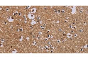 Immunohistochemistry of paraffin-embedded Human brain tissue using IFRD1 Polyclonal Antibody at dilution 1:40 (IFRD1 抗体)