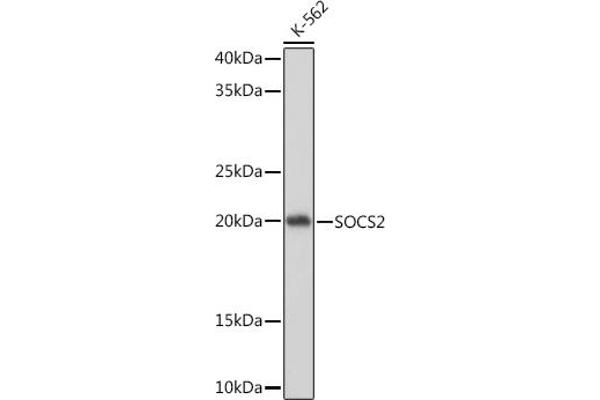 SOCS2 抗体