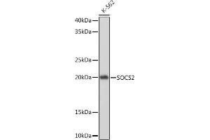Western blot analysis of extracts of K-562 cells, using SOCS2 Rabbit mAb (ABIN7270641) at 1:1000 dilution. (SOCS2 抗体)