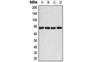 Western blot analysis of BMX (pY40) expression in MCF7 IL1b-treated (A), Jurkat CD3-treated (B), Raw264. (BMX 抗体  (N-Term, pTyr40))