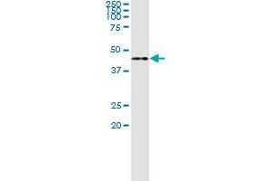 Immunoprecipitation of TWF1 transfected lysate using rabbit polyclonal anti-TWF1 and Protein A Magnetic Bead (TWF1 (人) IP-WB Antibody Pair)