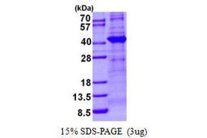 Image no. 1 for Tubulin Folding Cofactor C (TBCC) protein (His tag) (ABIN6387011) (TBCC Protein (His tag))