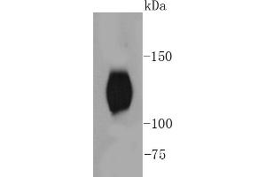 Mouse brain lysates, probed with TrkB(Y817) (2A1 ) Monoclonal Antibody  at 1:1000 overnight at 4˚C. (TRKB 抗体  (pTyr817))