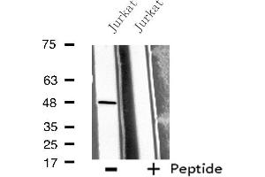 Western blot analysis of extracts from Jurkat cells, using BMP10 antibody. (BMP10 抗体  (Internal Region))
