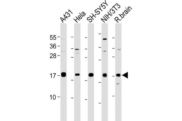 Calmodulin 1 抗体  (C-Term)