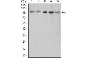 Western Blotting (WB) image for anti-5'-3' Exoribonuclease 2 (XRN2) (AA 398-547) antibody (ABIN5855738) (XRN2 抗体  (AA 398-547))