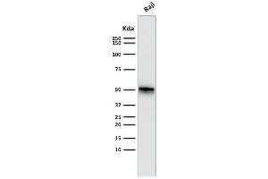 Western Blot Analysis of Raji cell lysate using CD79a Monoclonal Antibody (SPM550). (CD79a 抗体  (AA 202-216))