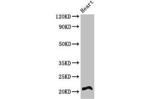 Western Blot Positive WB detected in: Mouse heart tissue All lanes: RCAN2 antibody at 3 μg/mL Secondary Goat polyclonal to rabbit IgG at 1/50000 dilution Predicted band size: 22, 28 kDa Observed band size: 22 kDa (RCAN2 抗体  (AA 88-197))