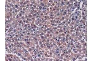 Used in DAB staining on fromalin fixed paraffin-embedded Heart tissue (FKBP3 抗体  (AA 2-224))