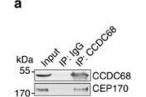CCDC68 interacts with CEP170 and is localized at the centrosomes. (CCDC68 抗体)