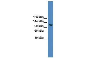 WB Suggested Anti-USP7 Antibody Titration: 0. (USP7 抗体  (Middle Region))