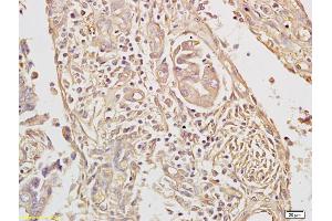Immunohistochemistry (IHC) image for anti-Nuclear Receptor Subfamily 2, Group C, Member 2 (NR2C2) (AA 560-600) antibody (ABIN701185)