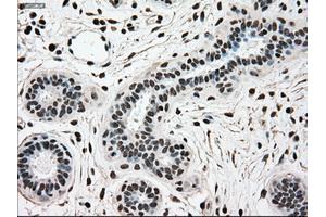 Immunohistochemical staining of paraffin-embedded breast tissue using anti-SCYL3 mouse monoclonal antibody. (SCYL3 抗体)