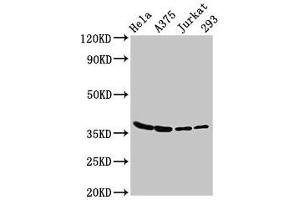 Western Blot Positive WB detected in: Hela whole cell lysate, A375 whole cell lysate, Jurkat whole cell lysate, 293 whole cell lysate All lanes: LDHA antibody at 3 μg/mL Secondary Goat polyclonal to rabbit IgG at 1/50000 dilution Predicted band size: 37, 31, 40, 27 kDa Observed band size: 37 kDa