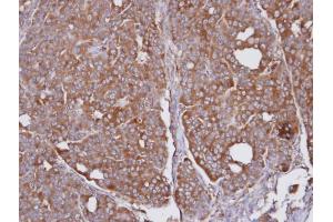 IHC-P Image Immunohistochemical analysis of paraffin-embedded NCI-N87 xenograft, using SEC31A, antibody at 1:100 dilution. (SEC31A 抗体  (N-Term))