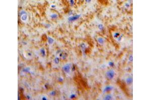 Used in DAB staining on fromalin fixed paraffin-embedded Brain tissue (DKK2 抗体  (AA 159-258))