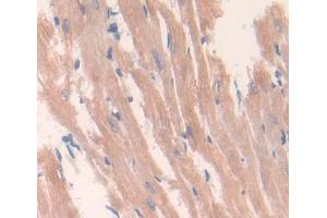 Used in DAB staining on fromalin fixed paraffin- embedded heart tissue (DNASEX 抗体  (AA 19-302))