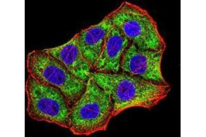 Immunocytochemistry (ICC) image for anti-BCL2/adenovirus E1B 19kDa Interacting Protein 3 (BNIP3) (AA 50-155) antibody (ABIN5542289)
