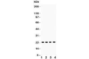 Western blot testing of RBP4 antibody and Lane 1:  rat liver;  2: mouse liver;  3: human HEPG2;  4: (h) COLO320 lysate. (RBP4 抗体  (AA 19-201))