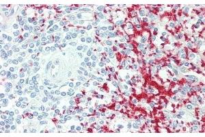 Immunohistochemistry (IHC) image for anti-Glycoprotein Ib (Platelet), alpha Polypeptide (GP1BA) (AA 19-291) antibody (ABIN7440512)