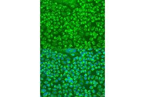 Immunofluorescence (IF) image for anti-Granzyme A (Granzyme 1, Cytotoxic T-Lymphocyte-Associated serine Esterase 3) (GZMA) (AA 29-262) antibody (ABIN6141551)
