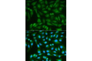 Immunofluorescence analysis of MCF7 cell using SORD antibody. (SORD 抗体  (AA 1-357))