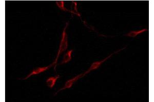 ABIN6274538 staining U87 by IF/ICC. (EPH Receptor A6 抗体)