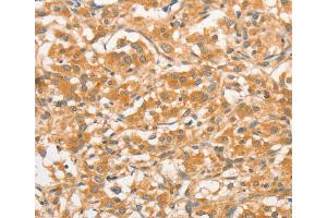 Immunohistochemistry (IHC) image for anti-Toll-Like Receptor 3 (TLR3) antibody (ABIN2422741) (TLR3 抗体)
