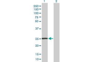 Western Blot analysis of IFNA8 expression in transfected 293T cell line by IFNA8 MaxPab polyclonal antibody. (IFNA8 抗体  (AA 1-189))
