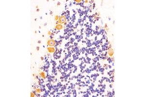 Immunohistochemistry (Paraffin-embedded Sections) (IHC (p)) image for anti-Sonic Hedgehog (SHH) (AA 58-91), (N-Term) antibody (ABIN6242830)