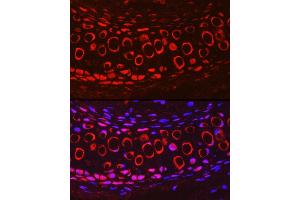 Immunofluorescence analysis of Mouse cartilage using COMP Rabbit pAb (ABIN6127650, ABIN6138864, ABIN6138866 and ABIN6221502) at dilution of 1:200 (40x lens). (COMP 抗体  (AA 20-160))