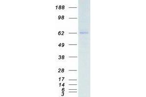 Western Blotting (WB) image for Cyclin-Dependent Kinase 17 (CDK17) protein (Myc-DYKDDDDK Tag) (ABIN2713857)