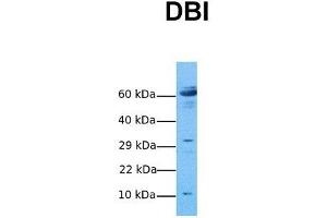 Host:  Rabbit  Target Name:  DBI  Sample Tissue:  Human Ovary Tumor  Antibody Dilution:  1. (Diazepam Binding Inhibitor 抗体  (N-Term))