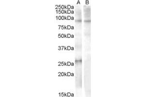 Western Blotting (WB) image for anti-Apolipoprotein B mRNA Editing Enzyme, Catalytic Polypeptide-Like 2 (APOBEC2) (Internal Region) antibody (ABIN2466475) (APOBEC2 抗体  (Internal Region))