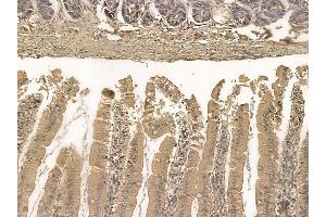 Cingulin Mouse Monoclonal Antibody at 1/100 staining rat colorectal tissue by IHC-P. (Cingulin 抗体)