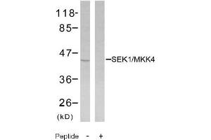 Image no. 2 for anti-Mitogen-Activated Protein Kinase Kinase 4 (MAP2K4) (Ser80) antibody (ABIN197325) (MAP2K4 抗体  (Ser80))