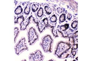 IHC analysis of HnRNPF using anti-HnRNPF antibody (ABIN4886622).