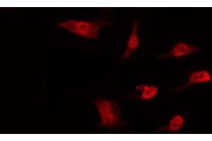 ABIN6274527 staining Hela by IF/ICC. (DNAJC17 抗体  (N-Term))