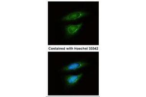 ICC/IF Image Immunofluorescence analysis of methanol-fixed HeLa, using LDH-B, antibody at 1:50 dilution. (LDHB 抗体)