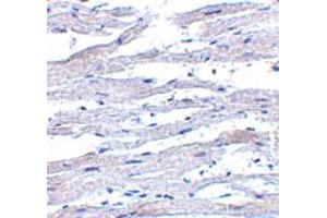 Immunohistochemistry of DDX58 in human heart tissue with DDX58 polyclonal antibody  at 5 ug/mL .