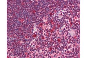 Anti-SNW1 antibody IHC of human thymus. (SNW1 抗体  (C-Term))