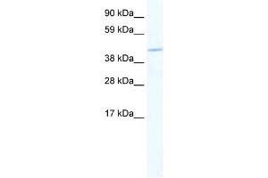 WB Suggested Anti-MEF2C Antibody Titration:  2. (MEF2C 抗体  (N-Term))