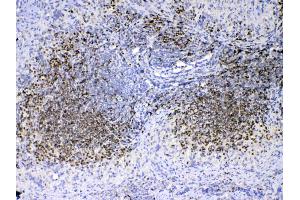 IHC analysis of PAX5 using anti-PAX5 antibody . (PAX5 抗体  (AA 217-282))