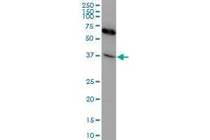 CXCR4 monoclonal antibody (M04), clone 2G9. (CXCR4 抗体  (AA 1-46))