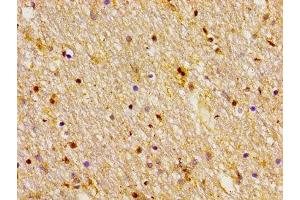 Immunohistochemistry (IHC) image for anti-Frizzled Family Receptor 1 (Fzd1) (AA 125-225) antibody (ABIN7153179)