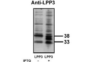 Image no. 1 for anti-Phosphatidic Acid Phosphatase Type 2B (PPAP2B) antibody (ABIN265045) (PPAP2B 抗体)