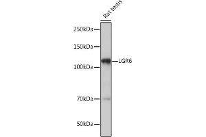 Western blot analysis of extracts of Rat testis, using LGR6 Rabbit mAb (ABIN7268235) at 1:1000 dilution. (LGR6 抗体)