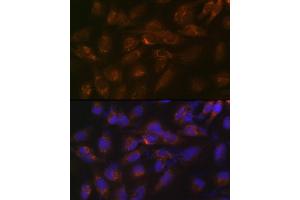 Immunofluorescence analysis of U-251 MG cells using IGFBP7 Rabbit mAb (ABIN7267910) at dilution of 1:100 (40x lens). (IGFBP7 抗体)