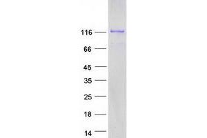 Western Blotting (WB) image for Kinesin Family Member 5C (KIF5C) protein (Myc-DYKDDDDK Tag) (ABIN2724246)